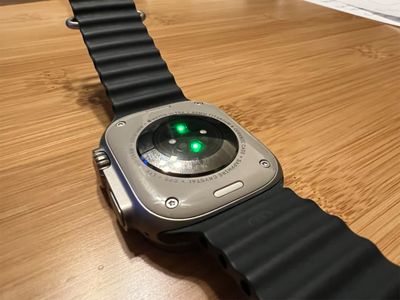 The optical heart rate sensors on the back of an Apple Watch Ultra 2 — the hardware that measures the millisecond gaps between heartbeats